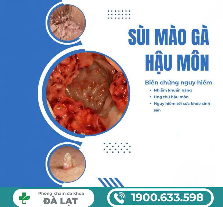 Hình ảnh minh họa